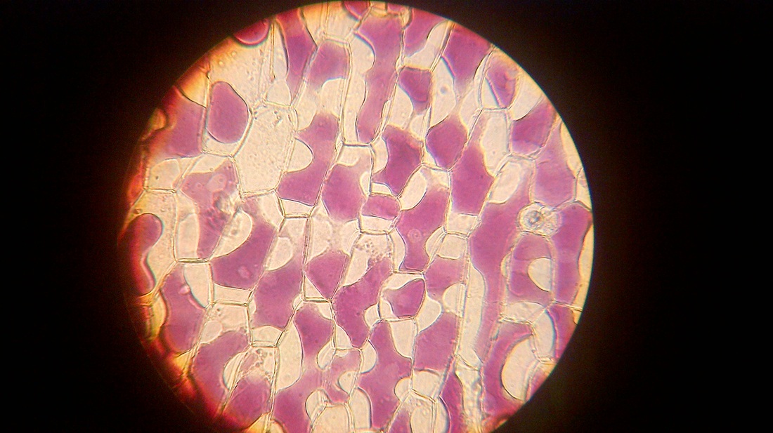 Red blood cells in hypertonic solutions